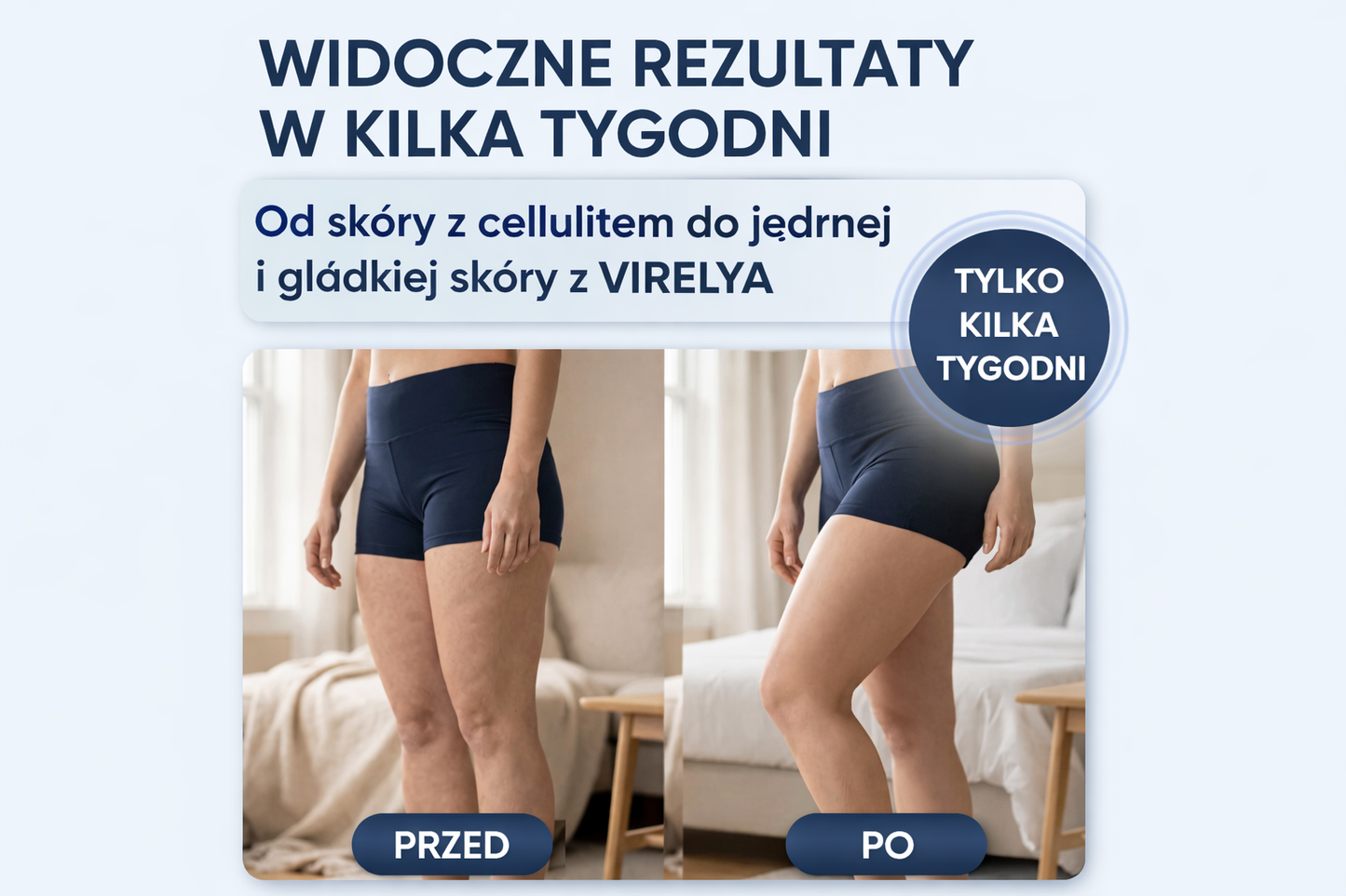 Virelya Pro